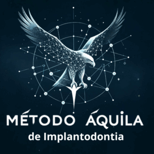 Método Áquila de Implantodontia por Igor Rizo